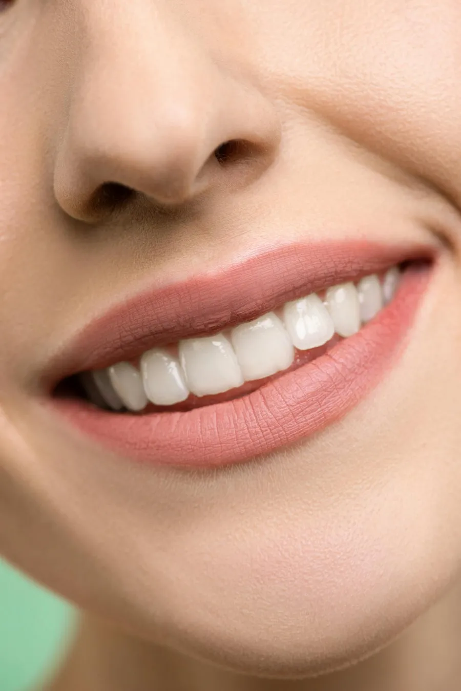 Beautiful smile transformation result achieved through Hollywood smile treatment at Taki Dent, Antalya, Turkey