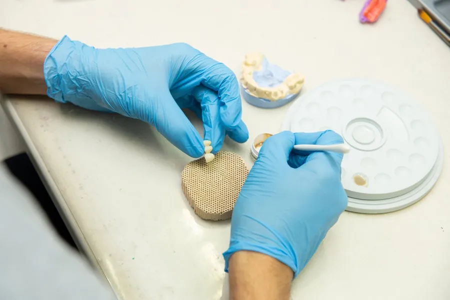 Dental crown fabrication process in a specialist dental laboratory at Taki Dent, Turkey