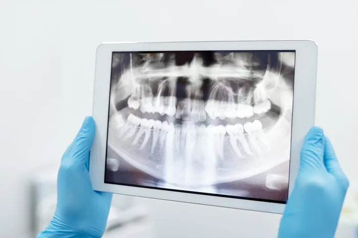 Dentist reviewing a dental X-ray on a tablet screen — digital diagnostic review is standard practice at quality clinics in Turkey