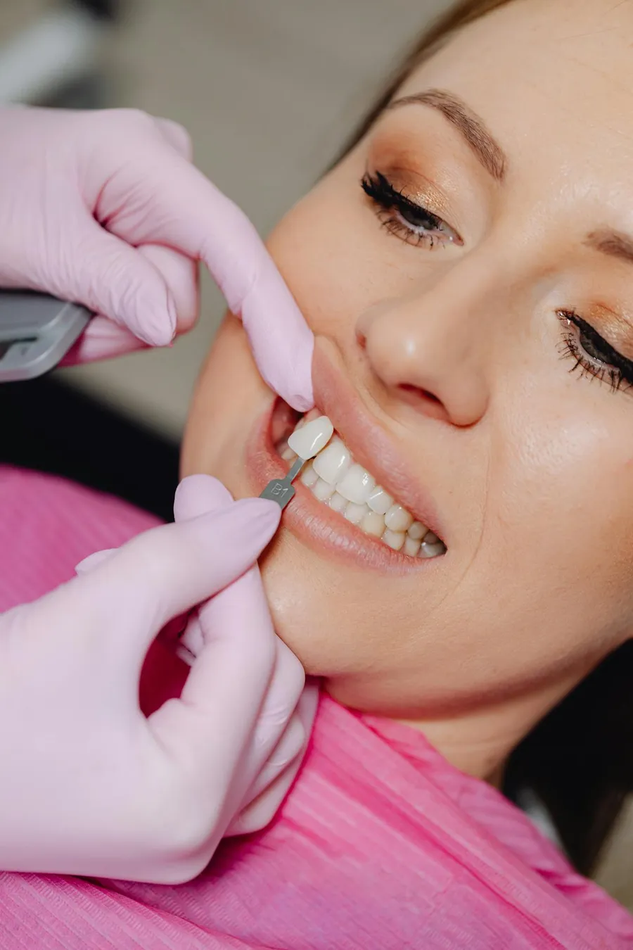 Hollywood smile design procedure in progress at a dental clinic in Antalya, Turkey